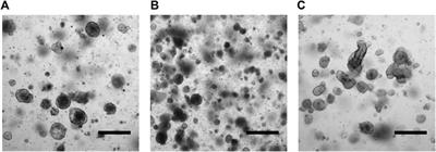 9-ING-41, a Small Molecule Inhibitor of GSK-3β, Potentiates the Effects of Chemotherapy on Colorectal Cancer Cells